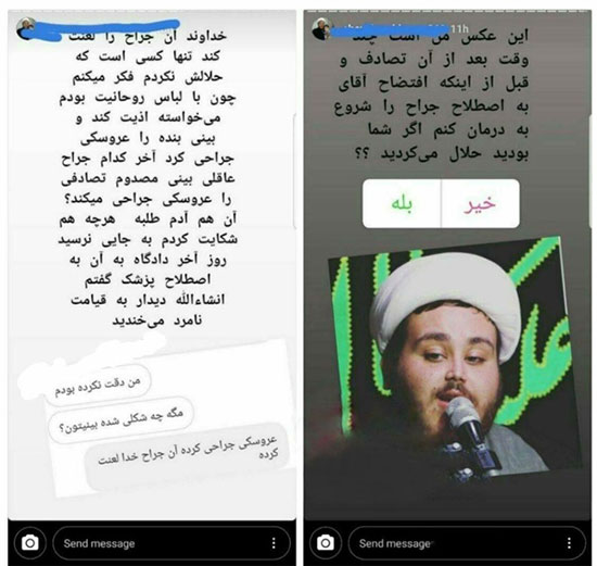 شکایت یک روحانی به خاطر «بینی عروسکیاش»!
