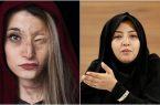 اظهارات تاسف برانگیز نماینده مبارکه و پاسخ قربانی اسید پاشی