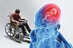 بهبود عوارض ام. اس به وسیله سلول‌های بنیادی مزانشیمی