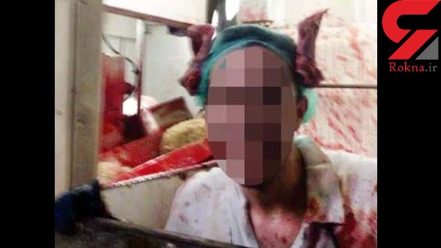 عکسی خون آلود که جنجال به راه انداخت ! + جزییات