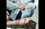 زخمی شدن محیط بان چهارمحال و بختیاری با تیر شکارچیان