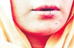 چند زن افغان لبهایشان را دوختند