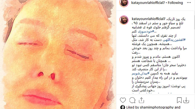 اقدام به خودسوزی بازیگر زن سینمای ایران +عکس