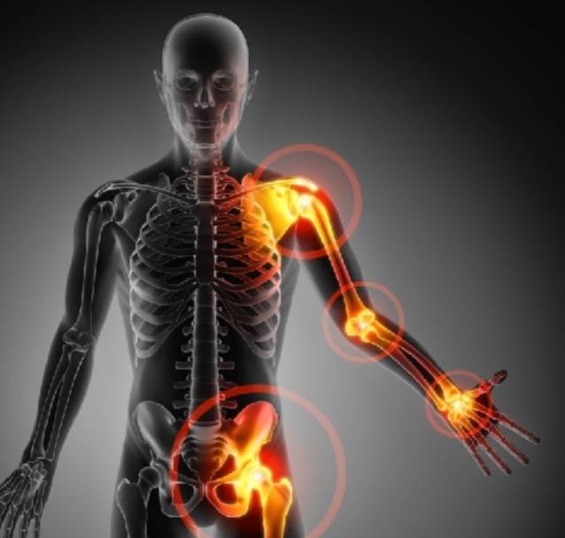آباتاسپت؛ تأخیر در روماتیسم مفصلی