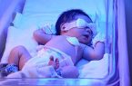 زردی نوزاد؛ از علائم طبیعی تا هشدارهای جدی